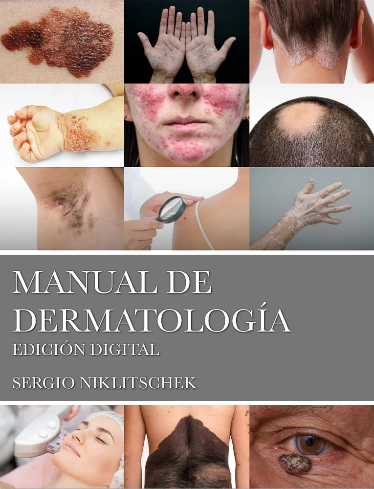 Portada del Manual de Dermatología del Dr. Sergio Niklitschek, edición digital