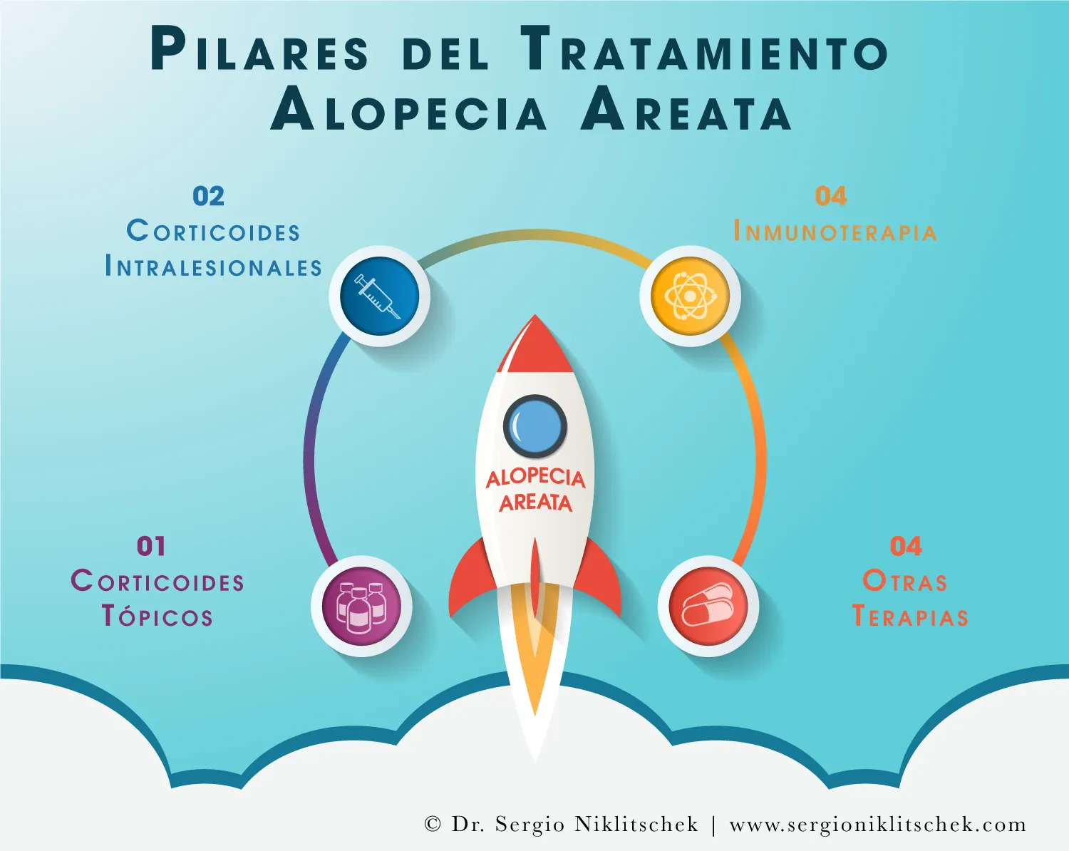 Infografía con los pilares del tratamiento de la alopecia areata: corticoides tópicos, corticoides intralesionales, inmunoterapia y otras terapias